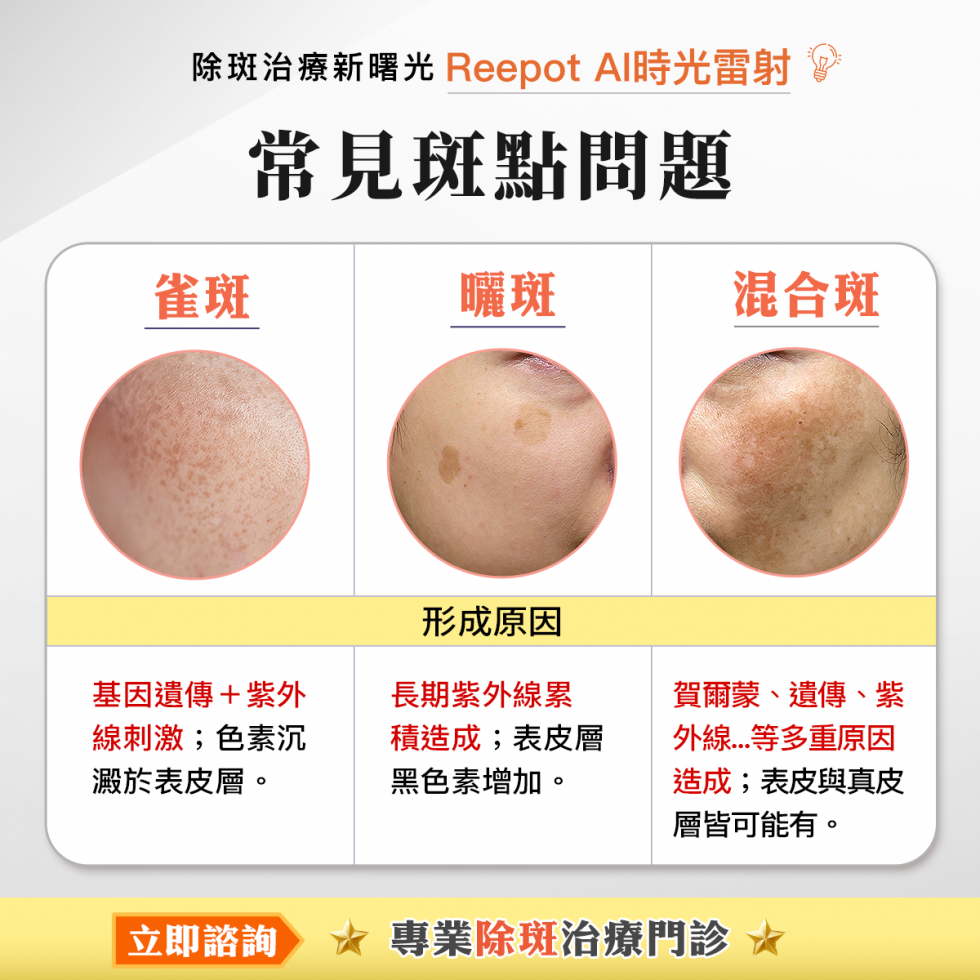 哪些人適合Reepot AI時光雷射（除斑雷射）治療？