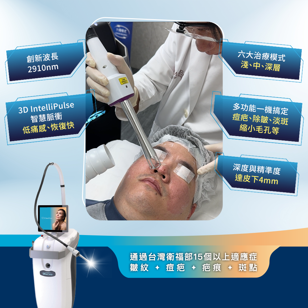 UltraClear冷纖雷射（痘疤雷射）五大特點