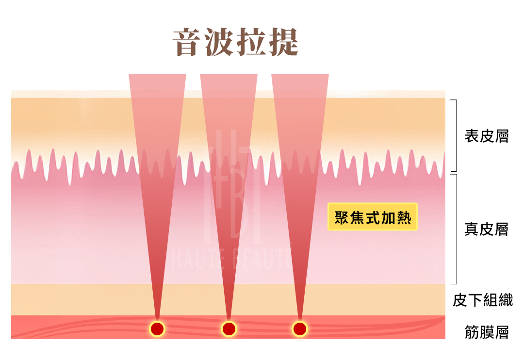 音波拉提原理示意圖