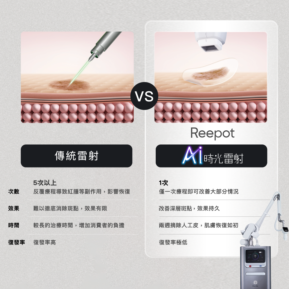 Reepot AI時光雷射 治療特點
